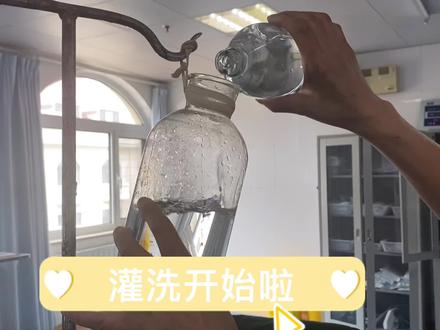 让我们来数数 单侧肺能洗出多少瓶黑水