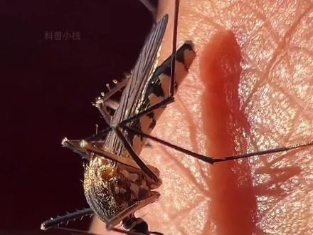 分享科普5种不同的蚊子,最后一种我爱了 #蚊子