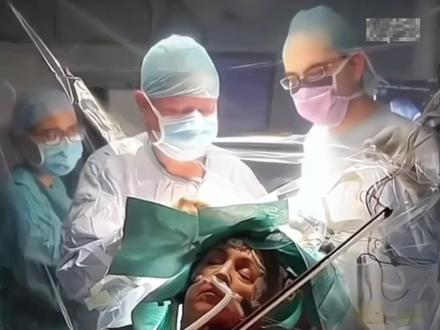 开颅手术有时候是需要患者清醒的 #医学科普