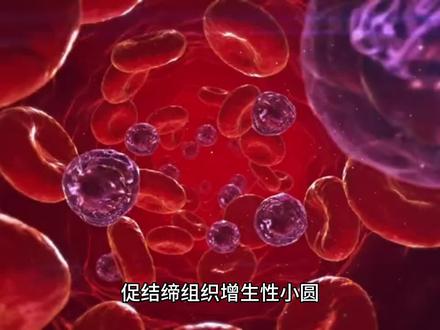 促结缔组织增生性小圆细胞肿瘤,肿瘤罕见,治疗难度较大!