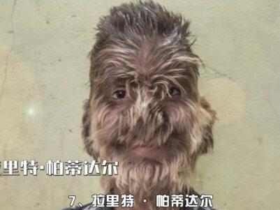 世界上九个罕见奇特的小孩,有的天生没有鼻子,有的心脏长在胸外(3/3)