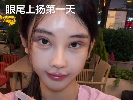 看我手里拿的什么#眼眶骨扩大 #狐系双眼皮 #美商