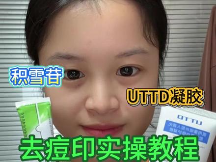 去痘印就像吃饭一样简单,进来抄作业
#痘印 #祛痘印 #油痘肌 #痘印怎么消除 #红痘印