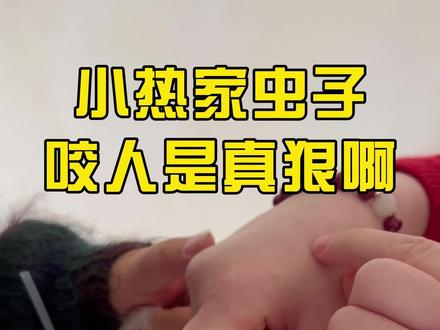 小热家虫子咬人是真狠啊#家居驱虫