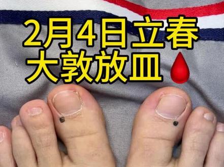 2026年立春的具体时间是公历2月4日,
北京时间凌晨4时01分51秒。
刺🩸最佳时间 早上 5-7点
次优时间 上午7-9点
男 先左脚再右脚
女 先右脚再左脚
#立春 #大敦穴#养生 #成都#温江