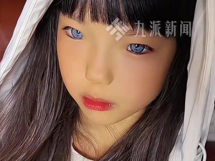 6月14日报道,北京,#8岁女童患罕见病眼睛变蓝 ,出生起就听不见声音。
