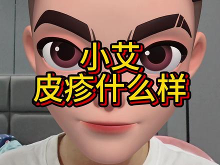 小艾皮疹有什么表现?#传染病四项 #恐艾 #为艾而战 #抗艾加油 #抗艾人生