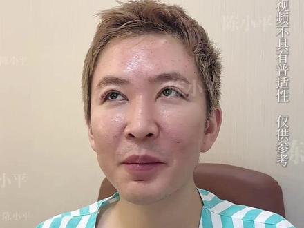 两次膨体都移位?peek鼻基底一次上岸! #鼻基底假体 #peek鼻基底 #鼻基底凹陷 #鼻基底修复