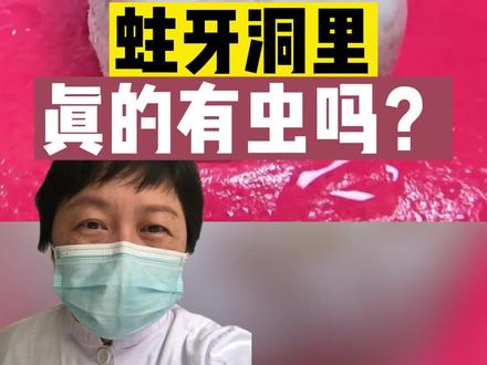 虫牙里面真的有虫吗?牙医带你实况探索龋洞#冷知识 #dou出新知 #金秋说健康 #虫牙 #龋齿 #长沙牙医 #儿童牙医曹姐 #儿童蛀牙 #长沙