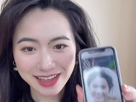 有美人尖但是显秃怎么修饰?简单一招告别秃头女孩#发型 #美人尖 #美人尖发际线