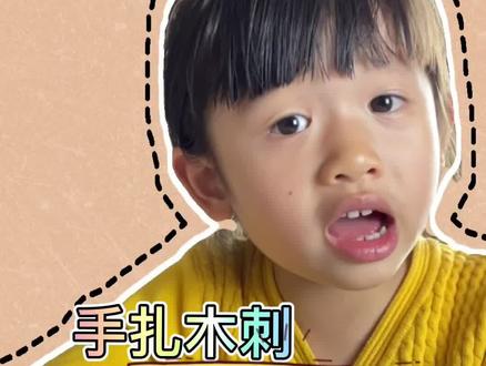 手扎木刺千万别着急,一个杯子就能教你两个轻松取出木刺的办法 #生活小妙招 #科普 #宝妈 @DOU+小助手