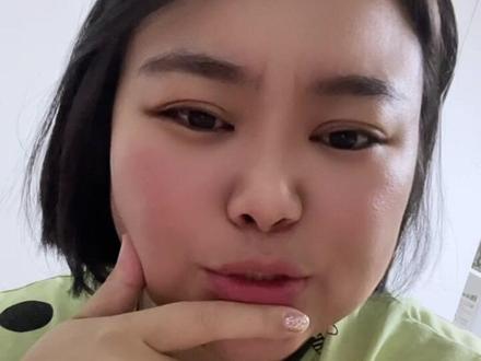 #袖状胃 #减肥 减肥真的很容易emo…