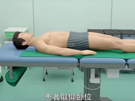 治腋臭3D演示#腋臭 #腋臭怎么办 #腋下管理 #昆明生活 #昆明皮肤管理