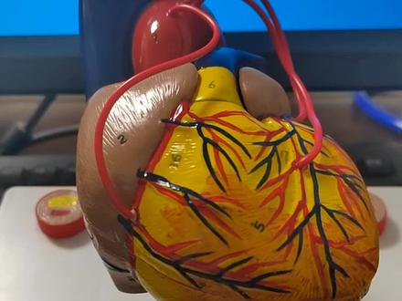 心脏病的常见检查有哪些?
一个检查能查出所有心脏问题吗?