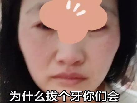 你没那个能力拔牙,能不能放过我,不要撕断我的舌神经