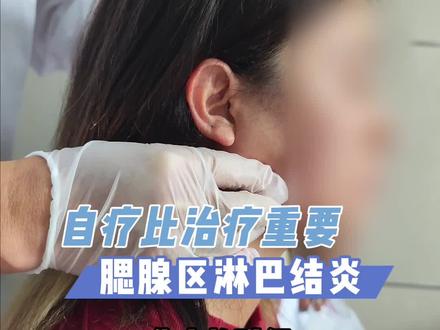 要注重日常生活
#杨雯君 #腮腺肿瘤 #诊室日常