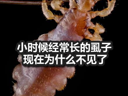 小时候经常长的虱子现在为什么不见了#热门#科普#虱子#动物#冷知识