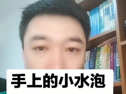 汗疱疹可以试试这个药,希望可以帮助到您!关注我,让您省钱又健康!