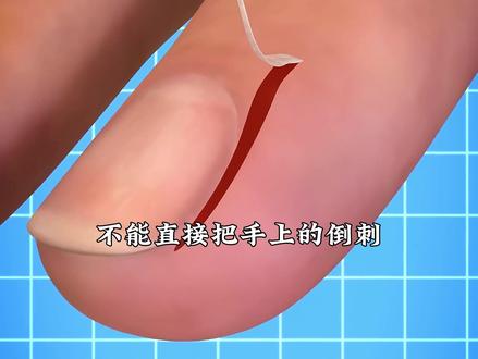 石膏锯的工作原理 #科普 #涨知识