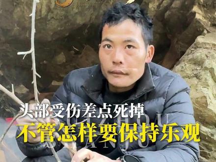 刀疤哥回忆受伤:差点死掉,做了三场手术,之后不管怎样要保持乐观