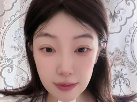 如何办理门特~微信版#门特 #怎么才能办门特 #甲状腺癌