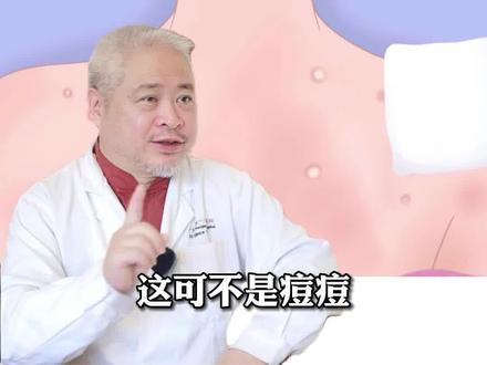 前胸后背长“痘痘”,密密麻麻总反复,试试这个办法#科普 #毛囊炎 #特比萘芬喷雾