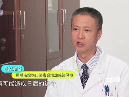 身体有小伤口时可用唾液暂时消毒?专家这样解释,不要再被误导了@抖音小助手 #抖incity美好生活节 #健康