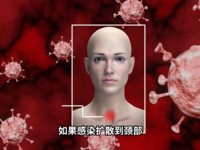 耳朵上的“小洞”千万不能挤!#科学脑洞上分赛 #万物杂志