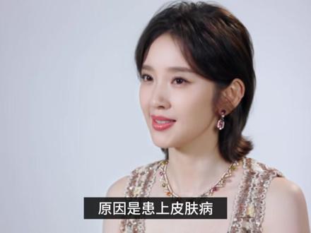 唐艺昕回应4年没拍戏:产后患皮肤病无法根治 张若昀深夜发文应援
#唐艺昕 #张若昀