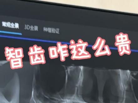 你们那里拔智齿多少钱#阻生牙拔除 #拔智齿 #日常vlog