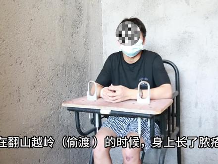 真会割腰子、砸手指…缅北回流人员亲诉惨痛经历!