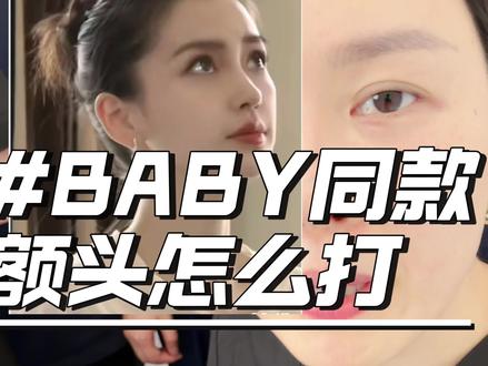 Baby同款额头怎么做#明星同款 #额头 #莎芮美学苑 #Sara老师 #额结节