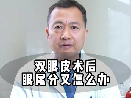 做#双眼皮 后出现眼尾分叉?这条视频帮助你#医学科普 #专业的事交给专业的人 #希望能帮到有需要的人 @DOU+小助手