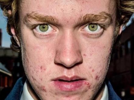 布鲁斯·吉尔登(Bruce Gilden),玛格南摄影师,以极其野蛮的拍摄方式闻名,走着走着突然举起闪光灯,扑到你的脸上摁下快门。#摄影 #人文 #街头摄影 #纪实摄影