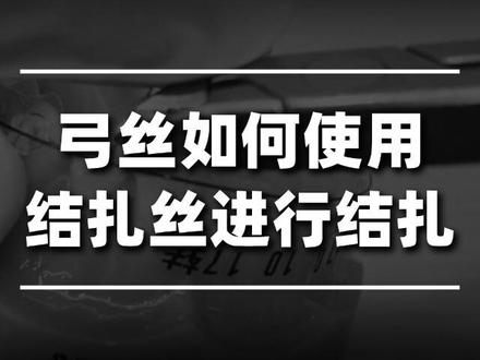 正畸中弓丝如何使用结扎丝进行结扎
固定矫治培训课程中会有详细介绍
在临床中说到的这种成品的结扎丝它一般都是成卷的,那这样的话如果要是在口腔内去每颗牙结扎
就会比较麻烦。这种成品的结扎丝首先我们可以找一个这样的硬式的小卡片然后把它一圈一圈缠到这个卡片上面,那我们把它缠完之后呢可以找一把剪刀然后把这个位置给它剪断。然后就会得到一个这样的一捆的这种大概是一张卡片长度的结扎丝,那我们就可以把这个结扎丝再抽出来一根,抽出来一根之后然后我们把中间对折留出大概1个厘米左右的间隙,然后这样缠绕几圈然后用持针器给它夹上
准备开始结扎,然后我们在临床中为了方便,我们可以先取一根结扎丝,然后我们找一根这样的吸唾管,把这个结扎丝缠到这个吸唾管上。然后再进行把它缠紧,但也不用缠的特别的紧,大概留个5个毫米左右的间隙,然后这样把这个结扎丝推到顶端
这样的话我们就可以更方便说等到患者来复诊的时候取一些结扎丝直接就进行结扎了,然后我们在临床中给患者结扎的时候我们可以首先取一些这种结扎丝然后首先拿出一个结扎丝夹到这个持针器的上面我们可以把这个结扎丝的末端稍微压一下,这样避免说在旋转的时候扎到这个患者的皮肤。首先我们结扎一下上牙,如果要是上牙的话我们会习惯性先扎上面的两个翼,然后再扎上颌方的两个翼,这样把这四个翼都扎好然后进行旋转持针器,然后使用细丝切断钳把末端长出的结扎丝给剪掉,大概需要预留3个毫米左右的结扎丝。然后这个时候呢,我们可以使用这种持针器或者镊子把这个长出的结扎丝,压到主弓丝的下面去这样避免结扎丝翘出来扎嘴🔑
#正畸 #正畸医生 #正畸培训 #正畸课程#牙医