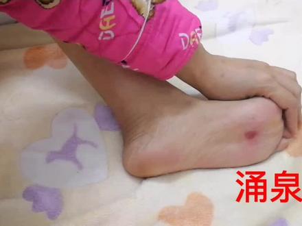 拍打涌泉穴能起到引火下行的作用,对上火,高血压,头痛目眩效果很好#高血压#热门#养生