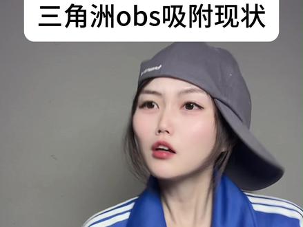 三角洲obs吸附现状 #三角洲行动
