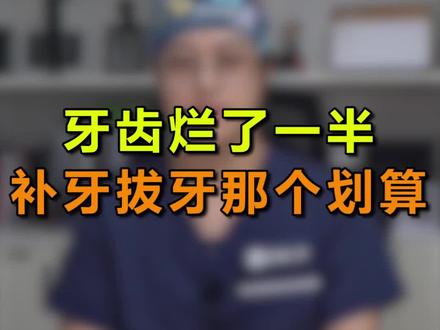 牙齿烂了一半,补牙和拔牙哪个划算呢?#医学科普 #口腔健康
