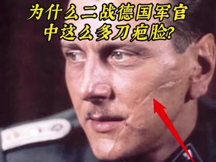 为什么二战德国军官中这么多刀疤脸?