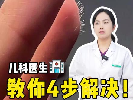 家里这些东西别乱碰,可能都有玻璃纤维!
#抖出健康知识科普 #医学科普 #健康科普 #玻璃纤维 #科普一下