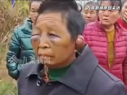 12月7日,湖南平江县,#村民回应女子疑被家暴到智力出问题 :以前正常,现在呆呆的,不好说。#村民称75岁家暴男子喜欢喝酒。