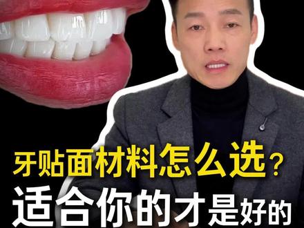 你的牙齿漂亮吗?#笑容是最高级的名片