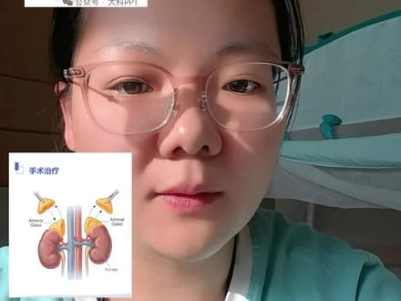 库欣综合征一定需要鉴别病因位置,垂体?肾上腺?还是异位?药物可选择的有三类,可以联合使用,一线推荐依然是手术。#抖出健康知识宝藏 #我的年度健康盘点#硬核健康科普行动 #库欣综合征 #健康咨询来小荷 #上热搜