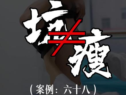 很多家长以为漏斗胸的大坑是瘦的,在门诊上这会已经不是第一位家长这么说了,很多人劝我说工作都这么累了,还要抽时间拍视频图啥呢?很多家长和我说多亏看了我的科普视频,才发现自己的孩子有漏斗胸,要不就真给孩子耽误了,这就是我做短视频科普的意义!#漏斗胸 #鸡胸 #漏斗胸鸡胸医生张东升