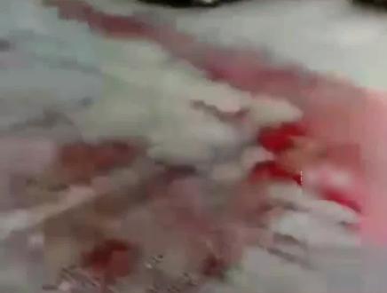 轿车撞上电动车留下满地鲜血 司机下车瞬间被吓惨#交通事故