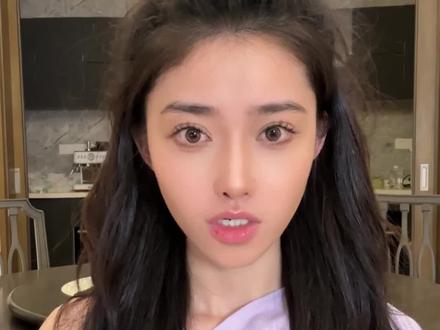 每一个坑都是一个故事#变美 #鼻子 #避坑