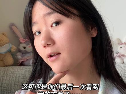 和自己的方脸和解了!🍄去了!#削骨 #磨骨改脸型 #下颚骨