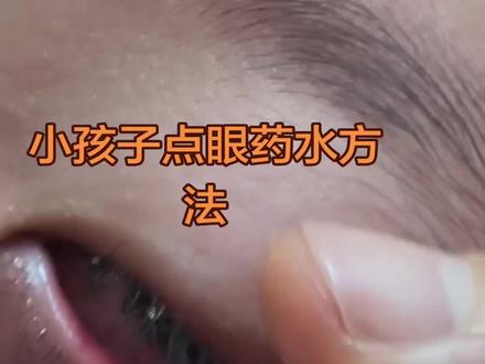 小孩子点眼药很费事,只要不点到角膜,也就是黑眼球,基本上没感觉,这样眼药水就容易进去#干眼症#正确点眼药水的方法 #睑板腺按摩@抖音创作小助手 @抖音小助手