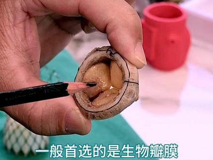 人工心脏瓣膜长啥样 #机械瓣膜 #生物瓣膜 #机械瓣和生物瓣的区别 #山东省立医院心外科 #心外科医生王正军