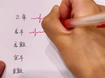 手绘心电图#护士 #实习护士 #护士懂护士